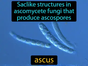 saclike structures in ascomycete fungi that produce ascospores