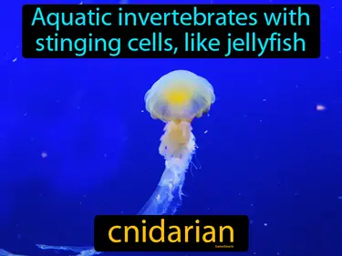 aquatic invertebrates with stinging cells, like a jellyfish