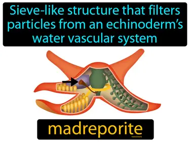 sieve-like structure that filters particles from an echinoderm’s water vascular system