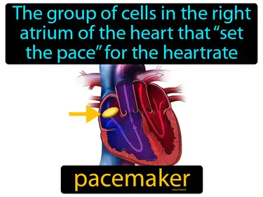 the group of cells in the right atrium of the heart that “set the pace” for the heartrate, the sinoatrial node