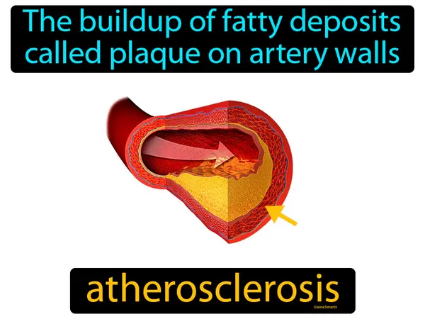 the buildup of fatty deposits called plaque on artery walls